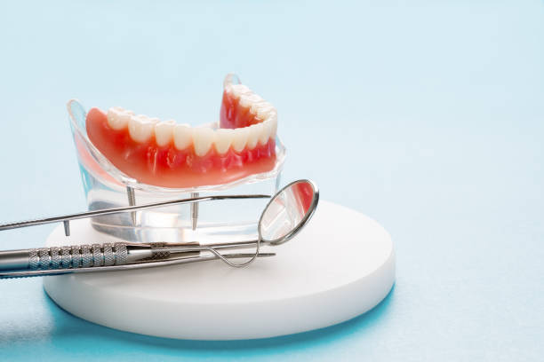 Why Choose Us for Your Dental Needs in Lely, FL